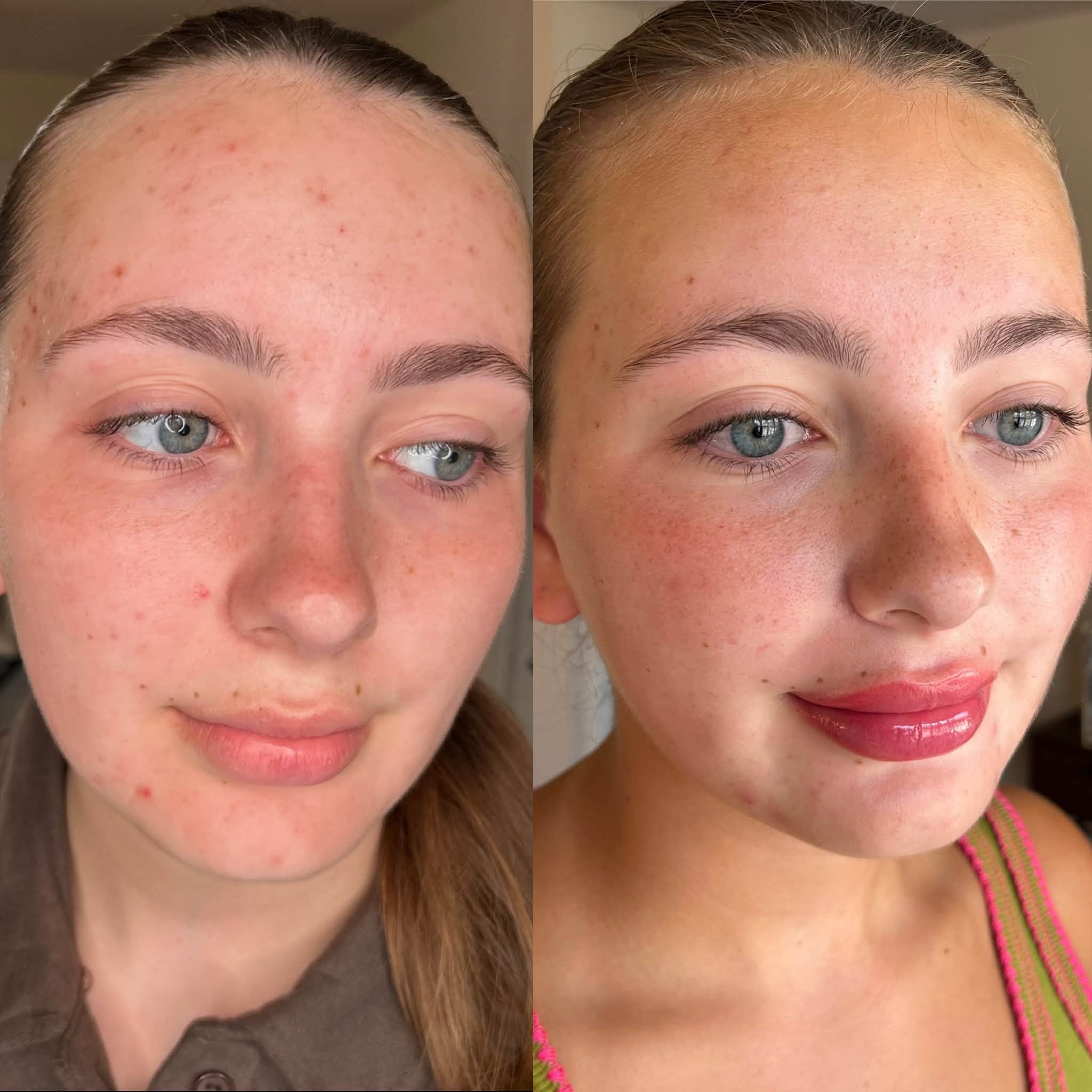 Lip blush permanent make up result by Louise Carr, South Wales